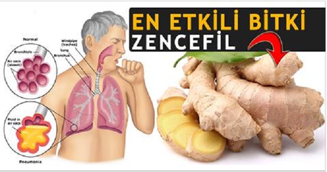 Gribe ve Nezleye Karşı Kalkan; Bal, Zencefil Limon Kürü