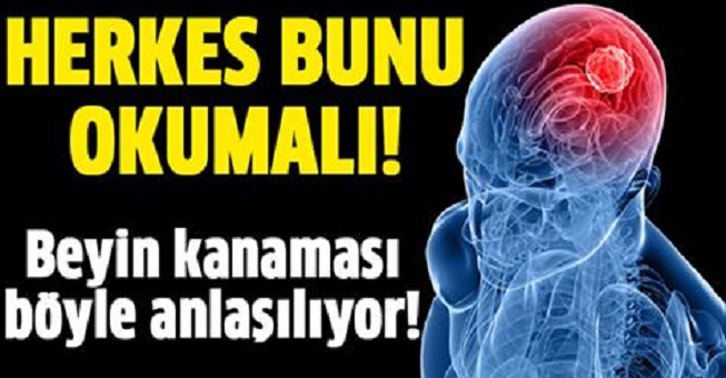 BEYİN KANAMASI BÖYLE ANLAŞILIYOR..!