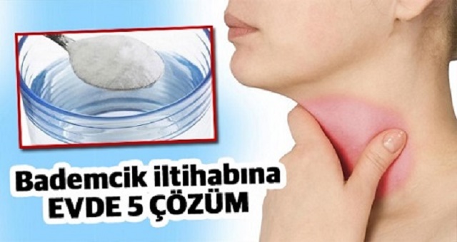 Antibiyotik kullanmadan bademcik iltihabını iyileştirmenin en basit yolu!